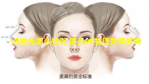 v8激光怎么祛斑 激光v8祛斑效果好吗
